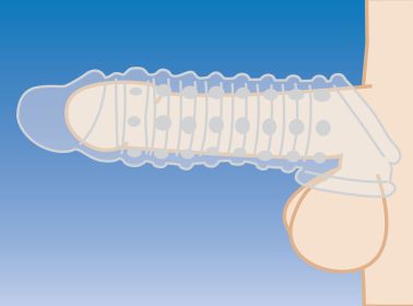 1.5 Inch Penis Enhancer Sleeve (Option: Clear)